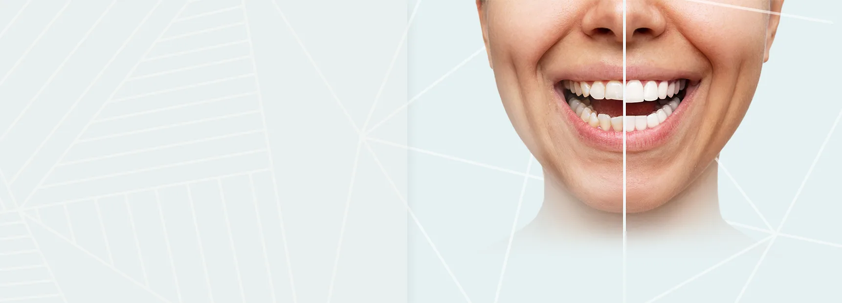 baner
